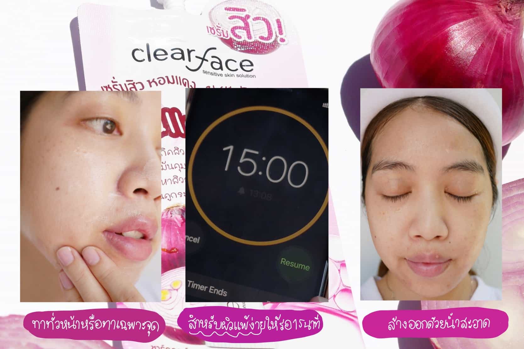 บอกต่อไอเทมเด็ดจาก Clearface กู้ผิวเสียให้ผิวสวย*ในราคาหลักสิบ*